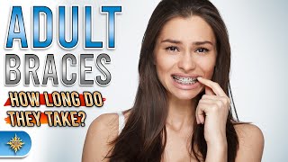 Adult Braces How Long Do They Take [upl. by Nas]