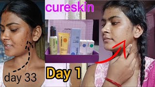 CURE SKIN APP REVIEW 🥹  cure skin app Honest review in bengali [upl. by Ij]