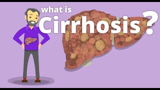 Cirrhosis of Liver Myths amp Facts [upl. by Narmis707]