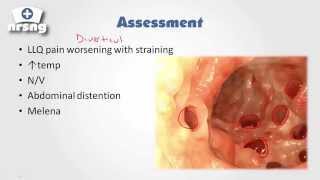 Diverticulitis ED Diagnosis and Treatment – 32nd Annual EM amp Acute Care Course [upl. by Akin799]