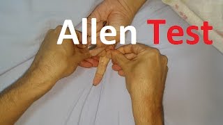 Allen´s Test  Radial vs Ulnar arteries [upl. by Ennoval]