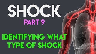 Identifying What Type Shock  Shock Part 9 [upl. by Jaylene970]