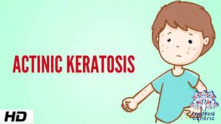 Actinic keratosis Causes Signs and Symptoms Diagnosis and Treatment [upl. by Sabec216]