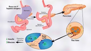 How tyrosine might help regulate glucose levels [upl. by Oswell]