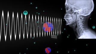 How Do Xrays Work [upl. by Isherwood5]