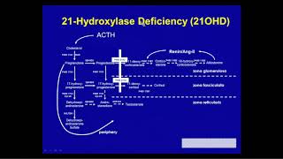 The Past Present and Future of Congenital Adrenal Hyperplasia [upl. by Kcirdderf656]