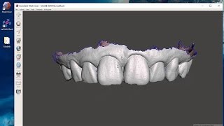 Introduction to Using Free Dental 3D Modeling Software amp Viewing STL Files [upl. by Marquet314]