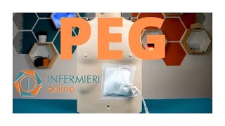 PEG  GESTIONE E MEDICAZIONE Gastrostomia Endoscopica Percutanea  LA NUTRIZIONE ENTERALE [upl. by Dygal365]