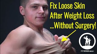 How To Fix Loose Skin After Weight Loss Men Without Surgery 5 Steps [upl. by Eynttirb544]