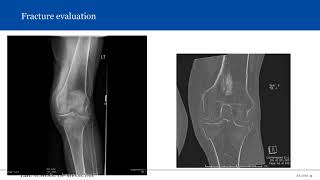 Introduction to Musculoskeletal Radiology [upl. by Mastrianni]