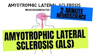 Webinar Nephrotic syndrome and FSGS [upl. by Airlie]