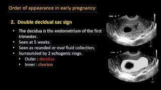 Ultrasound of normal early pregnancy [upl. by Ydniw327]