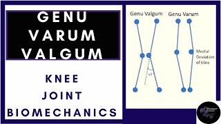 Tibiofemoral Alignment Knee joint biomechanics physiotherapy tutorials [upl. by Yroc]