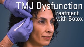 TMJ Dysfunction Treatment with Botox®  Sneak Preview [upl. by Hudson]