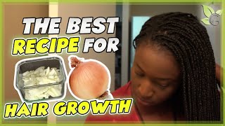 The BEST Onion Juice Recipe for Maximum HAIR GROWTH [upl. by Ajiram835]