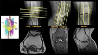 Resonancia Magnética de Rodilla Anatomía parte 1 [upl. by Barrada]