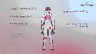 Symptome bei Lymphomerkrankungen [upl. by Stern]