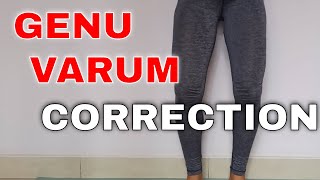 5 GENU VARUM CORRECTION EXERCISES  Yoga For Bow Legs [upl. by Thorrlow366]