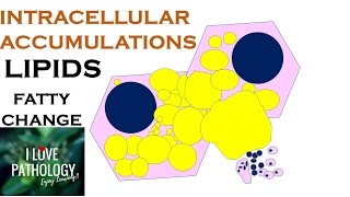 INTRACELLULAR ACCUMULATIONS LIPIDS Fatty Change [upl. by Ojyllek466]