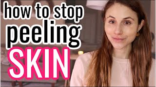 How to STOP PEELING SKIN Dr Dray [upl. by Randee]