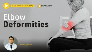 Elbow Deformities  Orthopaedic Surgery Tutorials  Clinical VLearning  sqadiacom [upl. by Ressan]