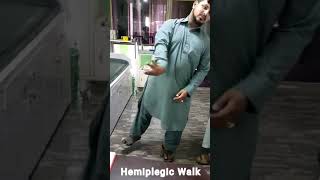 Hemiplegic Cerebral palsy  Hemiplegic gait [upl. by Otrebmuh525]