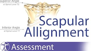 Scapular Alignment and possible causes for dyskinesia [upl. by Kimmy378]