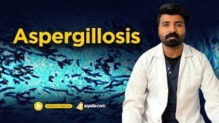 Aspergillosis  Infectious Clinical Medicine  Online Video Lectures  VLearning [upl. by Retsae]