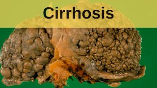 Liver Explained Function Pathology Diseases amp Cirrhosis [upl. by Sirtemed]