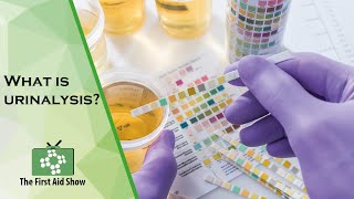 What is urinalysis [upl. by Eniroc760]