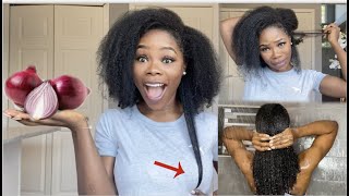 2 WAYS TO USE ONION JUICE FOR MASSIVE HAIR GROWTH  HOW TO USE ONIONS FOR EXTREME HAIR GROWTH [upl. by Atirehs530]