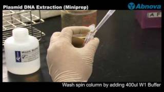 Plasmid DNA Extraction Miniprep [upl. by Wiersma]