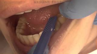 How To Use A Tooth Slooth [upl. by Gertrud870]