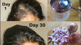 Regrow Lost Hair from Roots with Onion juice amp Coconut Hair Oil  Double hair growth amp get Long hair [upl. by Ellegna201]