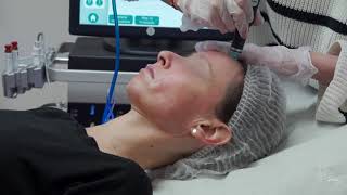 Hydrafacial  la séance complète de nettoyage de peau [upl. by Cutter]