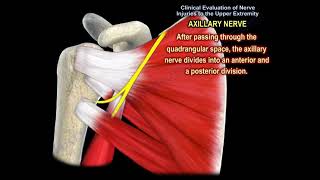 NERVE INJURY IN THE UPPER EXTREMITY Everything You Need To Know  Dr Nabil Ebraheim [upl. by Spoor]