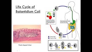 Balantidium Coli Class Ciliate Parasitology [upl. by Tesil67]