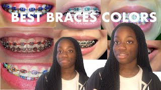 BEST BRACES COLOR TO GET [upl. by Ettenan]