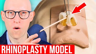 RHINOPLASTY Explained by Plastic Surgeon [upl. by Tnomed259]