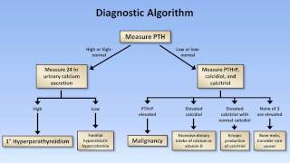 Hypercalcemia [upl. by Joell120]