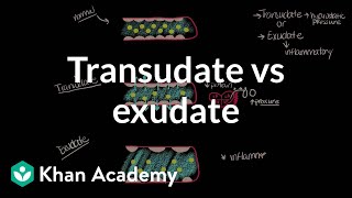 Transudate vs exudate  Respiratory system diseases  NCLEXRN  Khan Academy [upl. by Spalla]