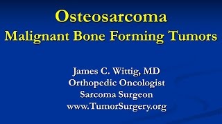 Orthopedic Oncology Course  Malignant Bone Forming Tumors Osteosarcoma  Lecture 4 [upl. by Ntsuj191]