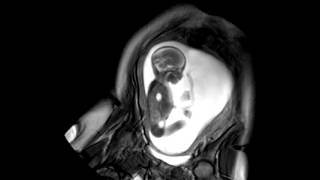 Foetal Development Unborn Baby Movement at 24 Weeks  WIRED [upl. by Jaddan117]