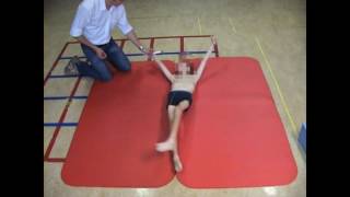 Dyskinetic cerebral palsy case 3 [upl. by Zita]