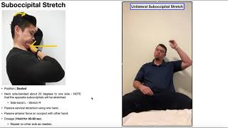 Suboccipital Stretch  Rationale amp Technique General amp Unilateral [upl. by Malha]