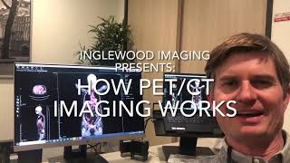 Understanding the PET Scan PETCT radiology test There are three parts PET CT amp fused images [upl. by Godbeare]