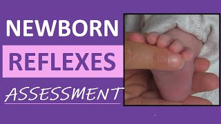 Newborn Reflexes Assessment Infant Nursing Pediatric NCLEX Review [upl. by Esnofla83]