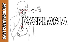 Approach to dysphagia difficulty swallowing  causes pathophysiology investigation [upl. by Erin]