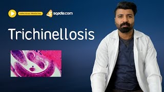 Trichinellosis  Infectious Disease Video Lectures  Medical Education  VLearning [upl. by Gabe]