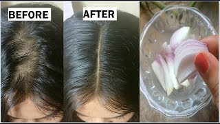 Onion amp Coconut oil for Extreme HAIR GROWTH in 30 Days to get long hair thick hair naturally [upl. by Droffilc314]